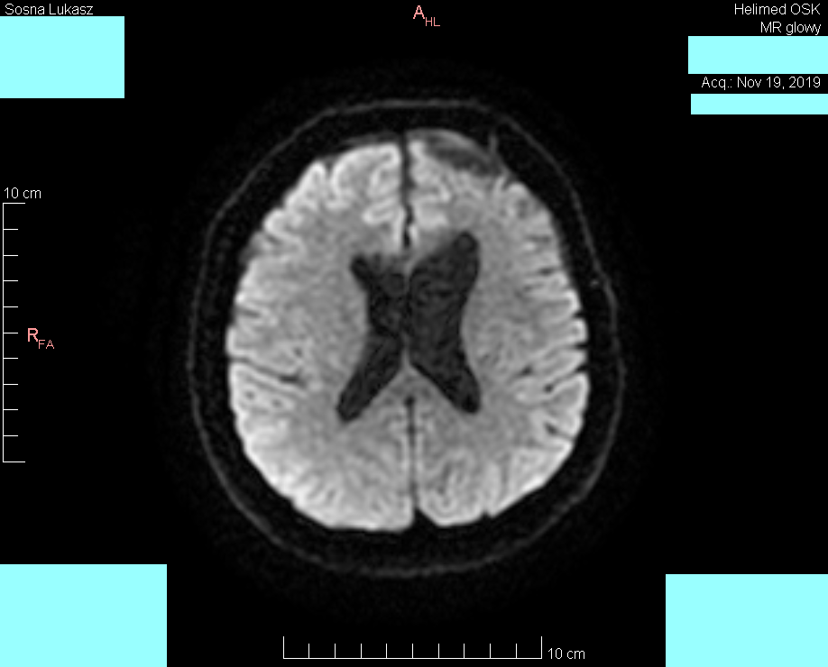 Head MRI result - Luke Sosna - year 2019 - image 7