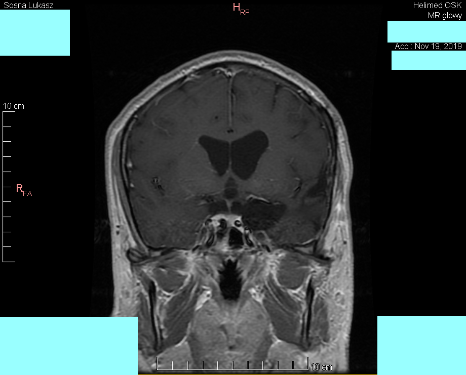 Head MRI result - Luke Sosna - year 2019 - image 9